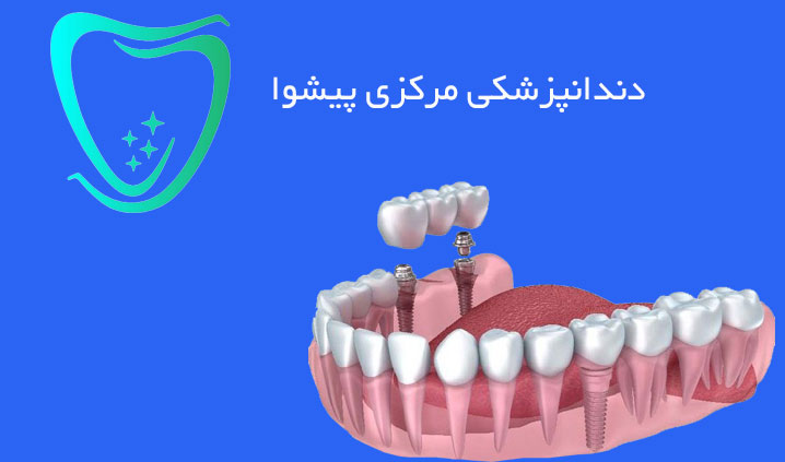 دندانپزشک زیبایی محدوده پیشوا